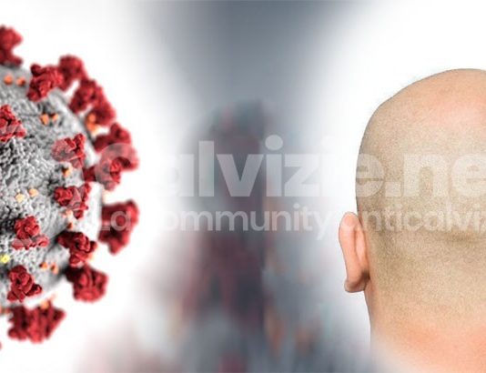Calvizie da Covid e nuove terapie coronavirus e calvizie