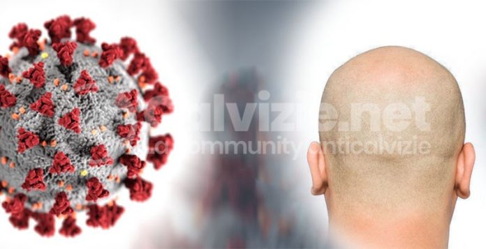 coronavirus e calvizie