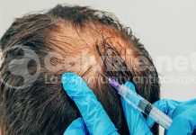 KeraMedix: cheratina per la crescita dei capelli keramedix