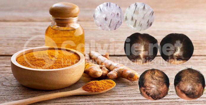 la curcuma funziona per i capelli