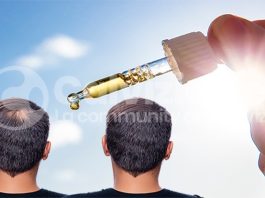 Vitamina D e calvizie