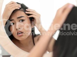 Calvizie femminile rimedi: qual è il più efficace? calvizie femminile rimedi