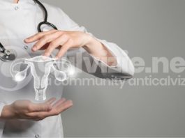 Ovaio policistico e calvizie femminile: il legame ovaio policistico e calvizie femminile