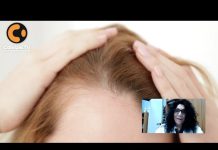 Alopecia femminile: intervista alla dott.ssa Giannatiempo