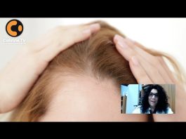 Alopecia femminile: intervista alla dott.ssa Giannatiempo