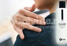 Il nuovo Kmax Healing Anti-Dandruff Shampoo antiforfora