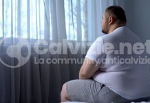 Sindrome metabolica, calvizie e alarina